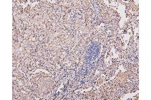 IHC analysis of COX IV using anti-COX IV antibody (ABIN7602090). (COX IV 抗体  (AA 59-169))