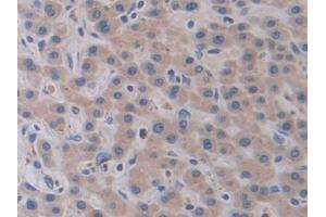 Detection of CTSV in Human Liver Tissue using Polyclonal Antibody to Cathepsin V (CTSV) (Cathepsin L2 抗体  (AA 64-334))