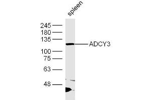 Mouse spleen lysates probed with ADCY3 Polyclonal Antibody, Unconjugated  at 1:300 dilution and 4˚C overnight incubation. (ADCY3 抗体  (AA 651-750))