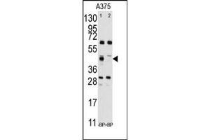Image no. 1 for anti-Farnesyl-Diphosphate Farnesyltransferase 1 (FDFT1) (Middle Region) antibody (ABIN357712) (FDFT1 抗体  (Middle Region))