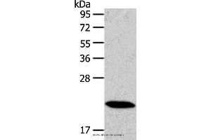 Western blot analysis of Mouse heart tissue, using RAB18 Polyclonal Antibody at dilution of 1:400 (RAB18 抗体)