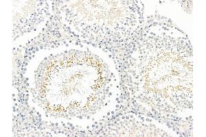 ABIN7093129 and ABIN7098933 at 1/100 staining Rat testis tissue by IHC-P. (BAGE2 抗体  (Internal Region))