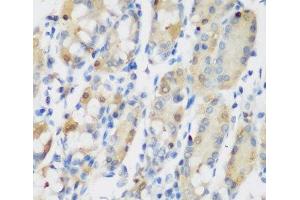 Immunohistochemistry of paraffin-embedded Human stomach using RRM1 Polyclonal Antibody at dilution of 1:200 (40x lens). (RRM1 抗体)
