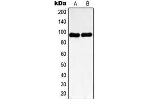 Western blot analysis of Nibrin expression in HeLa (A), HL60 (B) whole cell lysates. (Nibrin 抗体  (Center))