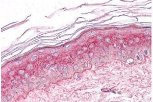 Human Skin: Formalin-Fixed, Paraffin-Embedded (FFPE) (GM2A 抗体  (C-Term))