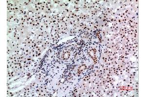 Immunohistochemistry (IHC) image for anti-B-Cell CLL/lymphoma 6 (BCL6) (Internal Region) antibody (ABIN3187827)