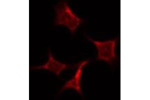 ABIN6274040 staining HepG2 by IF/ICC. (PRC1 抗体  (Internal Region))