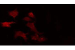 Immunofluorescence (fixed cells) (IF/ICC) image for anti-Amyloid beta Precursor Protein (Cytoplasmic Tail) Binding Protein 2 (APPBP2) (Internal Region) antibody (ABIN6257673)