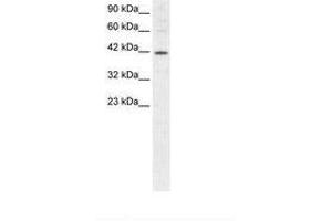 Image no. 1 for anti-Mesoderm Induction Early Response 1 (MIER1) (AA 250-293) antibody (ABIN202515) (MIER1 抗体  (AA 250-293))