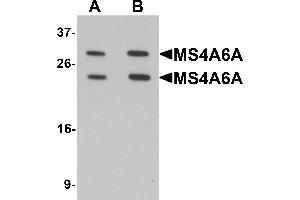 Western blot analysis of MS4A6A in 293 cell lysate with MS4A6A antibody at (A) 1 and (B) 2 µg/mL. (MS4A6A 抗体  (N-Term))