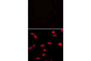 Immunofluorescence analysis of SET07 antibody and HeLa cells with (bottom) and without (top) PE-conjugated goat anti-mouse lgG secondary. (SETD8 抗体  (N-Term))
