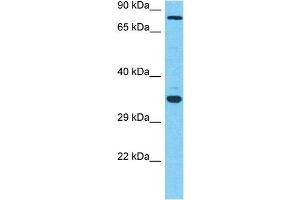 Host:  Rabbit  Target Name:  MGAT5  Sample Type:  OVCAR-3 Whole Cell lysates  Antibody Dilution:  1. (MGAT5 抗体  (C-Term))