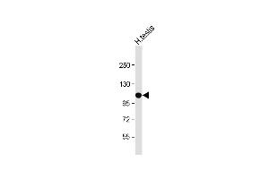 Anti-SLC14A2 Antibody (N-Term) at 1:500 dilution + Human testis lysate Lysates/proteins at 20 μg per lane. (Solute Carrier Family 14 (Urea Transporter, Kidney) Member 2 (SLC14A2) (AA 42-76) 抗体)