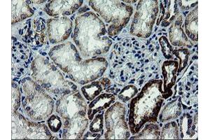 Image no. 3 for anti-Armadillo Repeat Containing 1 (ARMC1) antibody (ABIN1496727)