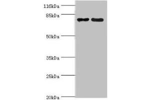 Western blot All lanes: MTRR antibody at 2 μg/mL Lane 1: PC-3 whole cell lysate Lane 2: HepG2 whole cell lysate Secondary Goat polyclonal to rabbit IgG at 1/10000 dilution Predicted band size: 81, 78, 7 kDa Observed band size: 81 kDa (MTRR 抗体  (AA 1-725))