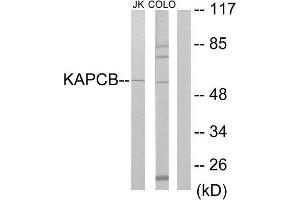 Western Blotting (WB) image for anti-Protein Kinase, CAMP Dependent, Catalytic, beta (PRKACB) (C-Term) antibody (ABIN1849250) (PRKACB 抗体  (C-Term))