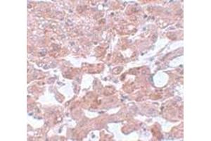 Immunohistochemistry (IHC) image for anti-Cell Division Cycle 16 Homolog (S. Cerevisiae) (CDC16) (N-Term) antibody (ABIN1031232) (CDC16 抗体  (N-Term))