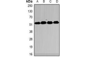 Western blot analysis of MeCP2 expression in HT29 (A), Jurkat (B), mouse spleen (C), mouse lung (D) whole cell lysates. (MECP2 抗体)