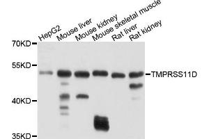 Western blot analysis of extracts of various cells, using TMPRSS11D antibody. (TMPRSS11D 抗体)