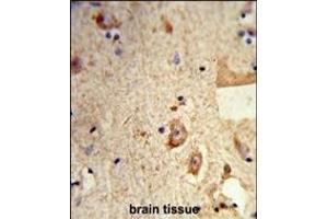 Immunohistochemistry (Paraffin-embedded Sections) (IHC (p)) image for anti-Destrin (Actin Depolymerizing Factor) (DSTN) (AA 70-98) antibody (ABIN653136)