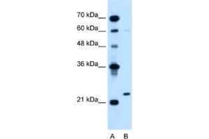 Western Blotting (WB) image for anti-Immunoglobulin lambda-Like Polypeptide 1 (IGLL1) antibody (ABIN2462601) (IGLL1 抗体)