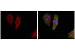 Immunofluorescence staining of methanol-fixed Hela cells showing cytoplasmic, nuclear staining using p44/42 MAP Kinase (Phospho-Thr202) Antibody. (ERK1 抗体  (pThr202))
