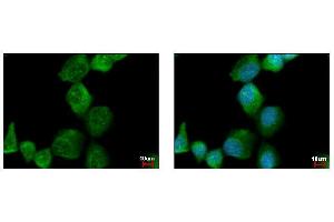 ICC/IF Image PAK1 antibody detects PAK1 protein at cytoplasm by immunofluorescent analysis. (PAK1 抗体  (Center))