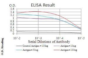 Black line: Control Antigen (100 ng), Purple line: Antigen(10 ng), Blue line: Antigen (50 ng), Red line: Antigen (100 ng), (IRAK3 抗体  (AA 454-596))