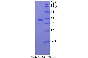 SDS-PAGE analysis of Cow Gelsolin Protein. (Gelsolin Protein (GSN))