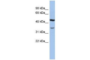 WB Suggested Anti-KCNK4 Antibody Titration:  0. (KCNK4 抗体  (N-Term))