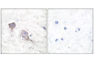 Immunohistochemical analysis of paraffin-embedded human brain tissue using SNAP25 antibody (ABIN5976506).