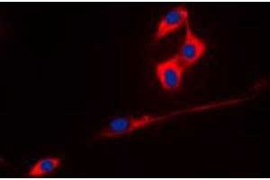 Immunofluorescent analysis of ECHOS1 staining in A431 cells. (TMPRSS3 抗体  (C-Term))