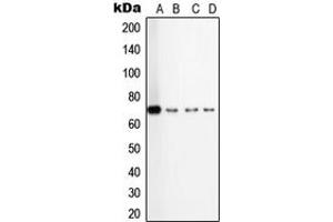 Western blot analysis of TGFBR2 expression in HepG2 (A), A549 (B), TF1 (C), KNRK (D) whole cell lysates. (TGFBR2 抗体  (Center))