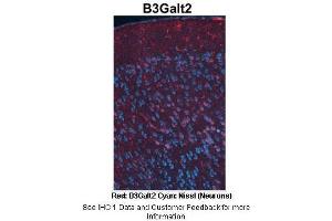 Immunohistochemistry (IHC) image for anti-UDP-Gal:betaGlcNAc beta 1,3-Galactosyltransferase, Polypeptide 2 (B3GALT2) (C-Term) antibody (ABIN2782253)