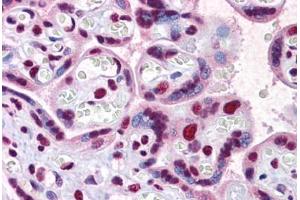 Human Placenta: Formalin-Fixed, Paraffin-Embedded (FFPE) (SCML1 抗体  (AA 3-101))