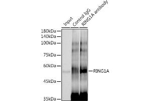 Immunoprecipitation analysis of 300 μg extracts of HeLa cells using 3 μg RING1A antibody (ABIN7270051). (RING1 抗体)