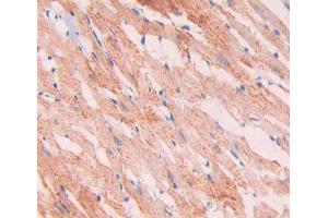 Used in DAB staining on fromalin fixed paraffin- embedded heart tissue (SNCAIP 抗体  (AA 766-963))