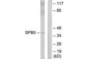 Western blot analysis of extracts from HeLa cells, using Serpin B5 Antibody. (SERPINB5 抗体  (AA 91-140))