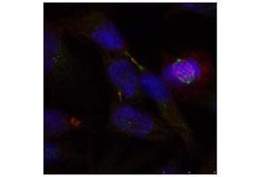 Image no. 2 for anti-ELK1, Member of ETS Oncogene Family (ELK1) (Ser389) antibody (ABIN197161) (ELK1 抗体  (Ser389))