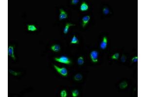 Immunofluorescence staining of A549 cells with ABIN7147330 at 1:100, counter-stained with DAPI. (TMEM2 抗体  (AA 734-866))