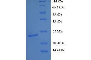 SDS-PAGE (SDS) image for Ephrin B3 (EFNB3) (AA 28-227) protein (His tag) (ABIN5713416)