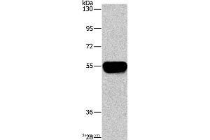 Western blot analysis of Human plasma tissue, using AHSG Polyclonal Antibody at dilution of 1:1450 (Fetuin A 抗体)