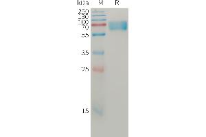 Beta-secretase 1 (BACE1) (AA 22-457) protein (His tag)