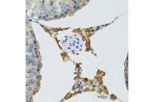 Immunohistochemistry of paraffin-embedded mouse testis using PLA2G2D antibody (ABIN5974036) at dilution of 1/100 (40x lens). (PLA2G2D 抗体)