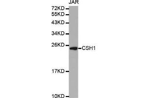 Western blot analysis of extracts of JAR cell line, using CSH1 antibody. (CSH1 抗体  (AA 27-217))
