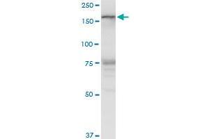 LMTK3 polyclonal antibody (A01), Lot # 060525JCS1. (LMTK3 抗体  (AA 1151-1250))