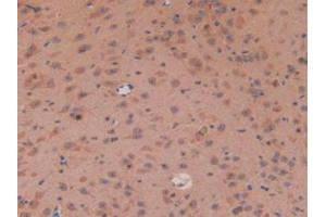 IHC-P analysis of Mouse Brain Tissue, with DAB staining. (APC 抗体  (AA 2636-2845))