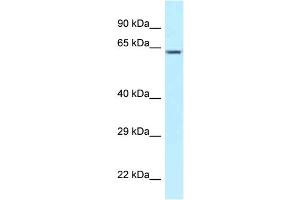 WB Suggested Anti-CCT3 Antibody Titration: 1. (CCT3 抗体  (C-Term))