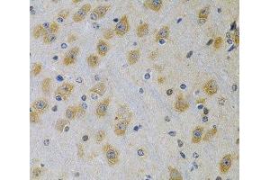 Immunohistochemistry of paraffin-embedded Rat brain using IGFBP4 Polyclonal Antibody at dilution of 1:100 (40x lens). (IGFBP4 抗体)