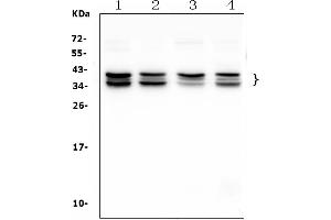 anti-N-Acetyltransferase 8-Like (GCN5-Related, Putative) (NAT8L) (C-Term) antibody